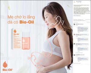Tinh dầu chống rạn da Bio Oil 125ml